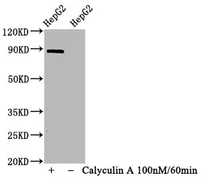 Phospho-STAT1 (S727) Recombinant Monoclonal Antibody - image 1