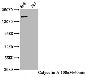 Phospho-SMC1A (S957) Recombinant Monoclonal Antibody - image 1