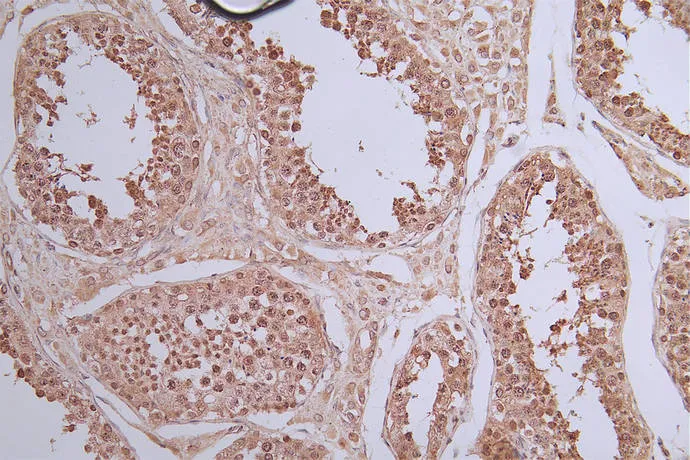 STAT1 Recombinant Monoclonal Antibody - image 1