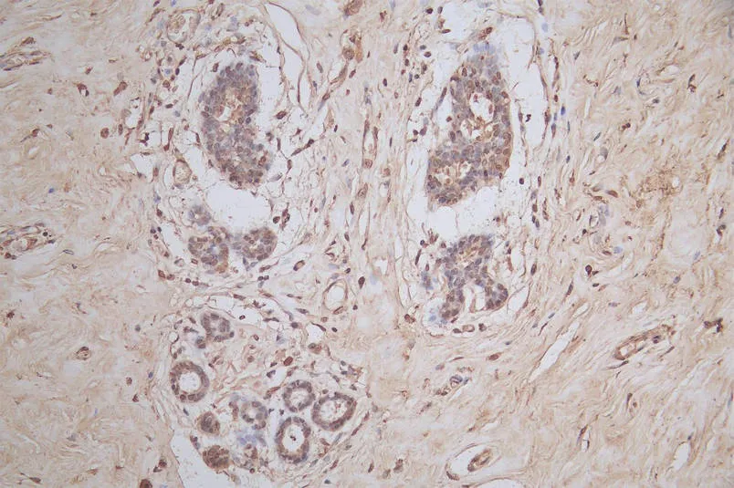 SNRPD1 Recombinant Monoclonal Antibody - image 1