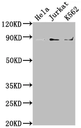 IKBKB Recombinant Monoclonal Antibody - image 1