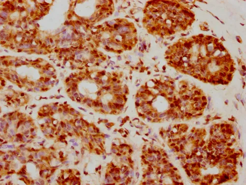 HIST1H2BC (Ab-5) Antibody - image 1
