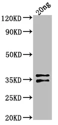 ARCA Antibody - image 1