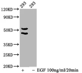 Phospho-MAPK8/MAPK9/MAPK10 (T183/T183/T221) Recombinant Monoclonal Antibody - image 1