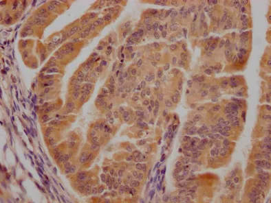 CDK6 Antibody - image 1