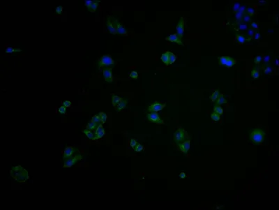 CDK6 Antibody - image 2