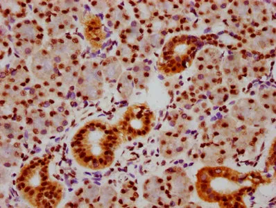 Phospho-SMAD5 (S463+S465) Recombinant Monoclonal Antibody - image 1