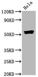 Phospho-SMAD5 (S463/S465) Recombinant Monoclonal Antibody - image 1