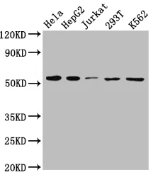SLC16A1 Recombinant Monoclonal Antibody - image 1