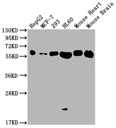ATP5A1 Recombinant Monoclonal Antibody - image 1