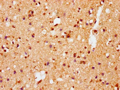 Phospho-SNCA (S129) Recombinant Monoclonal Antibody - image 1
