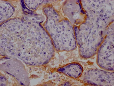 TPBG Recombinant Monoclonal Antibody - image 1