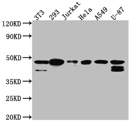 CSNK2A1 Recombinant Monoclonal Antibody - image 1