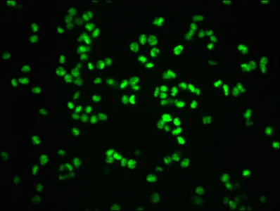 Phospho-RB1 (S807) Recombinant Monoclonal Antibody - image 1