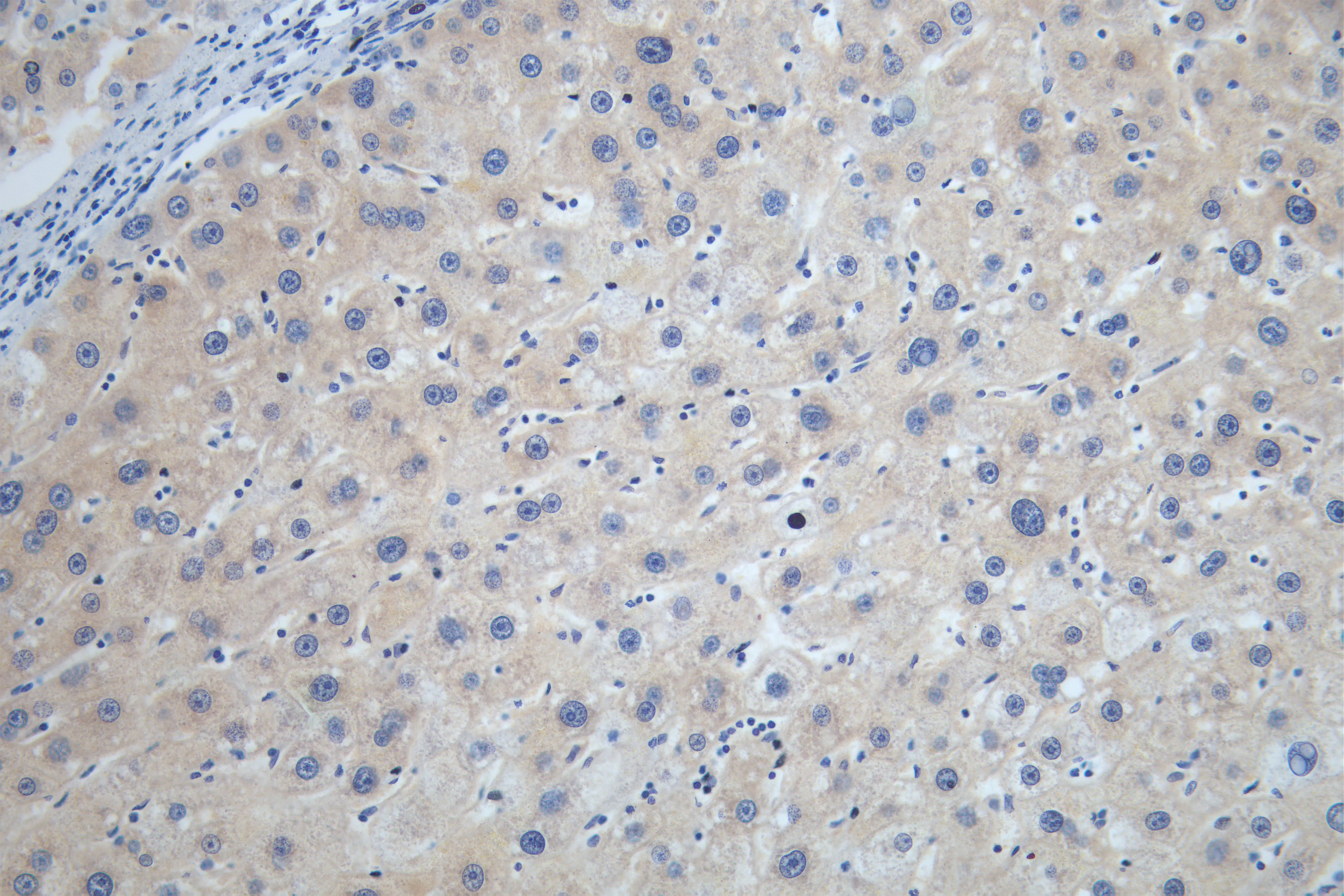 STK33 Recombinant Monoclonal Antibody - image 1