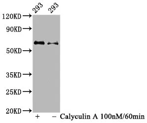 Phospho-AKT1 (Ser473) Recombinant Monoclonal Antibody - image 1