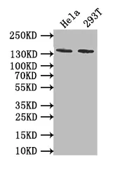 PKN2 Recombinant Monoclonal Antibody - image 1