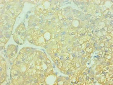 AHSG Monoclonal Antibody - image 1