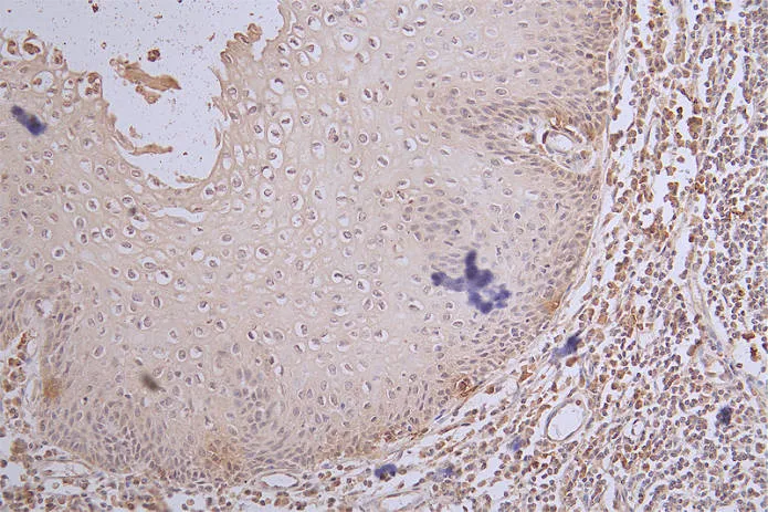 MKI67 Recombinant Monoclonal Antibody - image 1