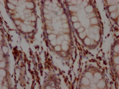 BCL2 Recombinant Monoclonal Antibody - image 2