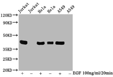 Phospho-MAPK3 (T202/Y204) + MAPK1 (T185/Y187) Recombinant Monoclonal Antibody - image 1