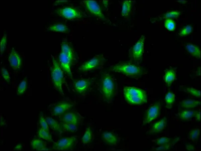 RHEB Recombinant Monoclonal Antibody - image 1