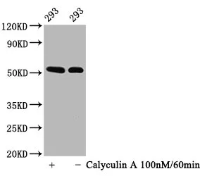 Phospho-TP53 (S392) Recombinant Monoclonal Antibody - image 1