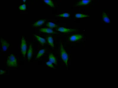 ADAM17 Recombinant Monoclonal Antibody - image 1