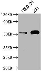 TP53 Recombinant Monoclonal Antibody - image 1