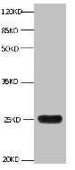 LCN2 Monoclonal Antibody - image 1