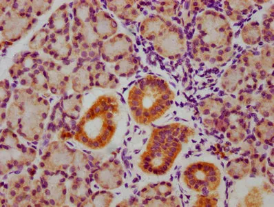 Phospho-GSK3A/GSK3B (Y216 + Y279) Recombinant Monoclonal Antibody - image 1