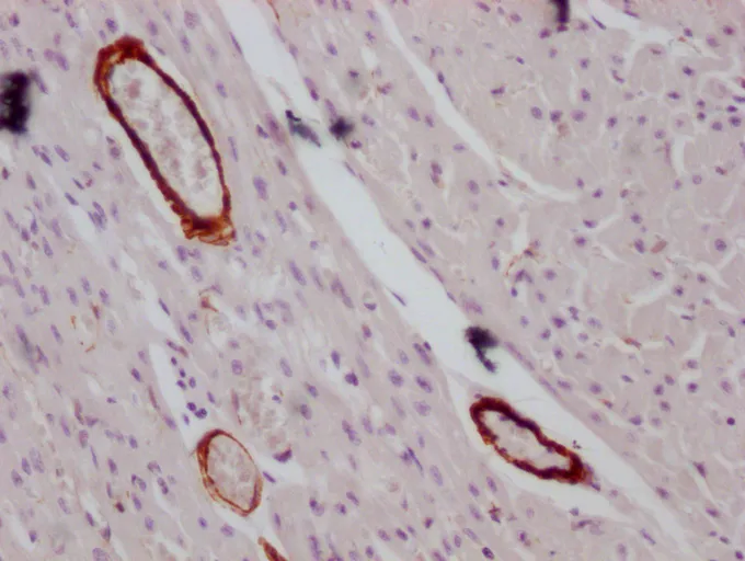 ACTA2/ACTG2 Monoclonal Antibody - image 1