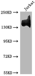 ITGA4 Recombinant Monoclonal Antibody - image 1