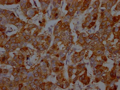 S100A9 Recombinant Monoclonal Antibody - image 1