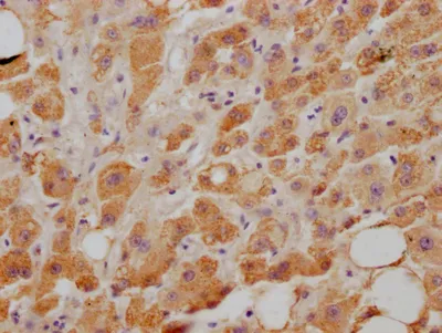 NPC1L1 Recombinant Monoclonal Antibody - image 1