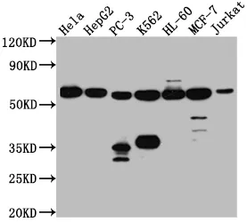 PTBP1 Recombinant Monoclonal Antibody - image 1