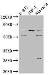 PTH1R Recombinant Monoclonal Antibody - image 1