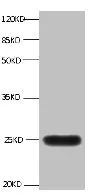 LCN2 Monoclonal Antibody - image 1