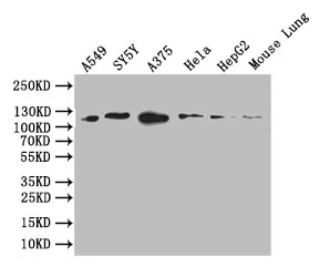 DDR2 Recombinant Monoclonal Antibody - image 1