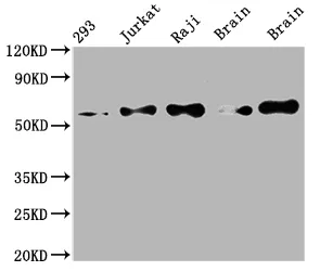 PAK2 Recombinant Monoclonal Antibody - image 1