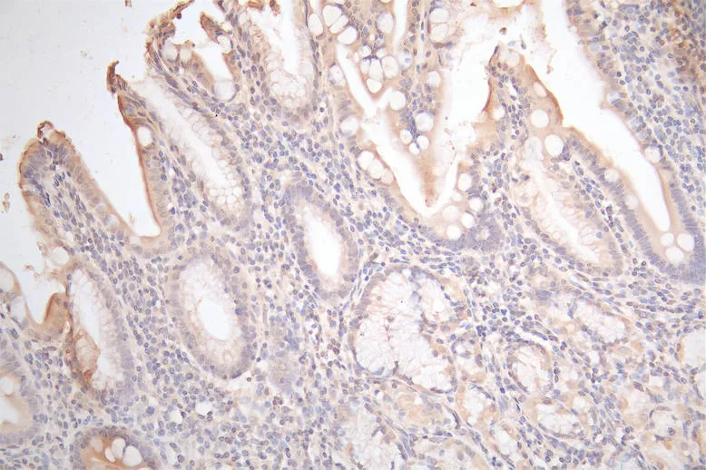GJB2 Recombinant Monoclonal Antibody - image 1