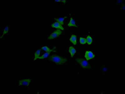 TP53 Recombinant Monoclonal Antibody - image 1