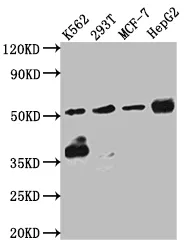 CHEK1 Recombinant Monoclonal Antibody - image 1
