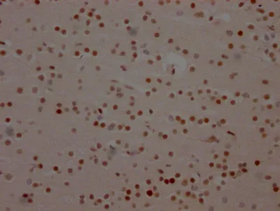 BRD4 Recombinant Monoclonal Antibody - image 2