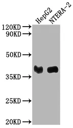 LCMT1 Antibody - image 1
