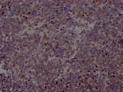 EZH2 Recombinant Monoclonal Antibody - image 1