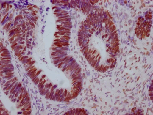 ESR1 Monoclonal Antibody - image 1