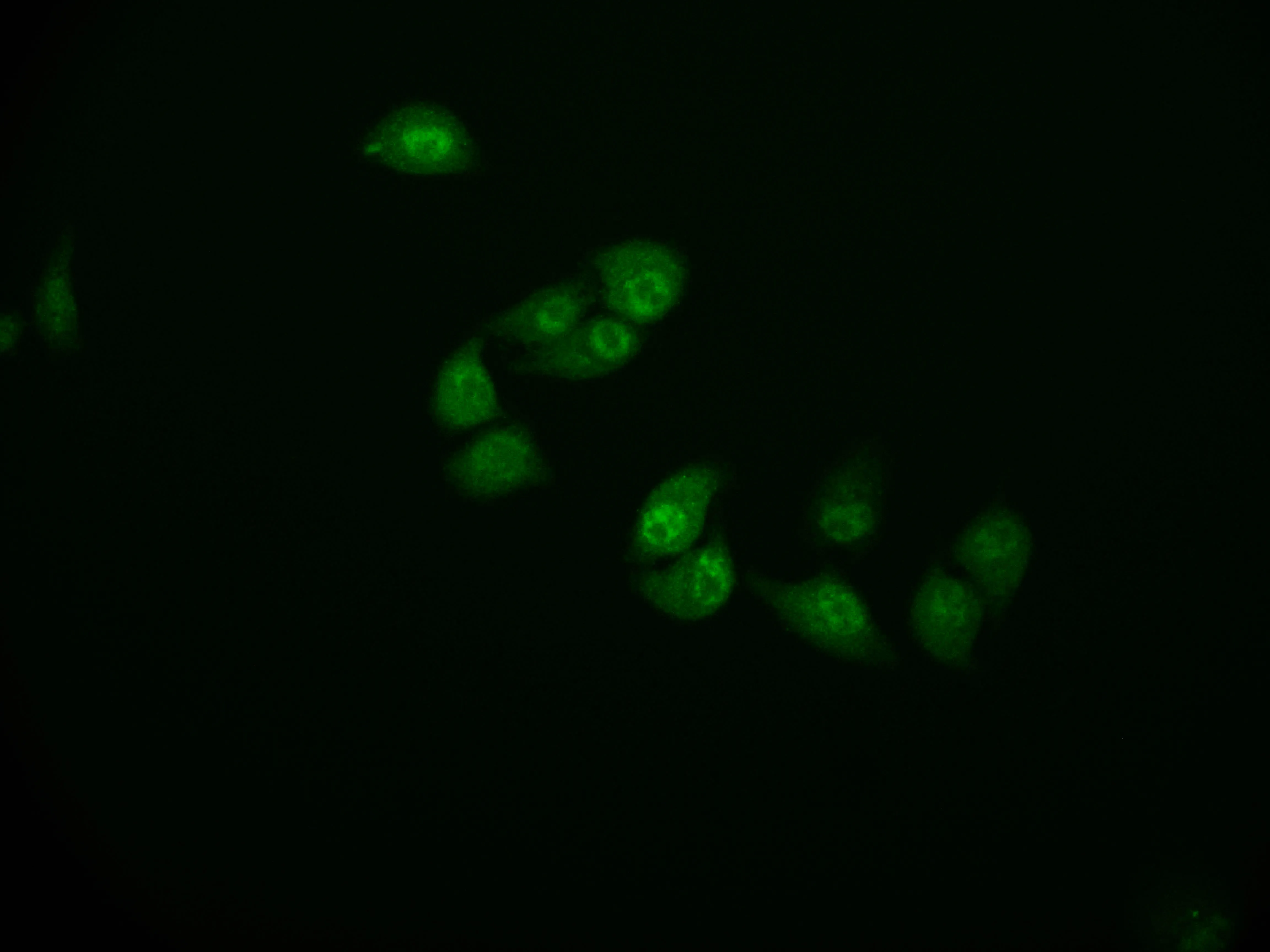 CSTB Recombinant Monoclonal Antibody - image 1