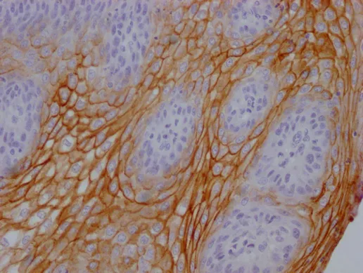 CEACAM5 Monoclonal Antibody - image 1