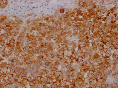 CEACAM5 Monoclonal Antibody - image 2